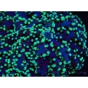WYSIWYG Euphyllia divisa 5 (Skeleton 9 cm/Flesh 19 cm)