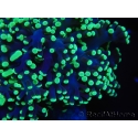 WYSIWYG Euphyllia divisa 12 (Skeleton 9 cm/Flesh 19 cm)