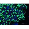 WYSIWYG Euphyllia divisa 12 (Skeleton 9 cm/Flesh 19 cm)