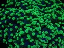 WYSIWYG Euphyllia divisa 23 (Skeleton 7 cm/Flesh 14 cm)