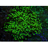 WYSIWYG Euphyllia paradivisa (Elevage Recifathome) 10A5