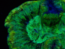 WYSIWYG - Trachyphyllia geoffroyi Ultra 9 (Skelett 7 cm/Geöffnet 12 cm)