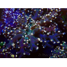 WYSIWYG Euphyllia paradivisa (Unter LED beleuchtete Marikultur-akklimatisiert)
