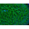 WYSIWYG - RAH Lobactis scutaria Blue/Green Tentacles élevage RAH 6 (6 cm)