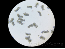 Rotifere type L Brachionus plicatilis Nourriture vivante 90 ml