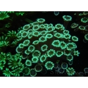 WYSIWYG Alveopora Molly Dream 17C2