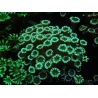 WYSIWYG Alveopora Molly Dream 17C2